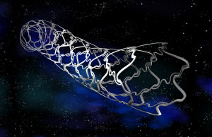 stent2
