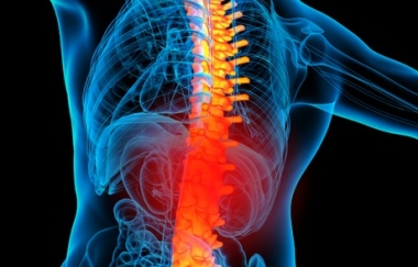 אוסטיאופורוזיס, עמוד השדרה, כאב גב תחתון