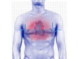 האם השלמת בדיקות לבביות לא-פולשניות לכאבי חזה מפחיתה את הסיכון הלבבי? (Circulation: Cardiovascular Quality and Outcomes)