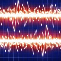 טכנולוגית בריאות דיגיטלית לבישה לחולי אפילפסיה (NEJM)