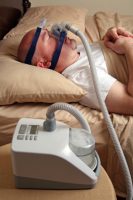דום נשימה חסימתי בשינה שאינו מטופל מלווה בפרוגנוזה גרועה יותר בחולים עם מלנומה (CHEST)
