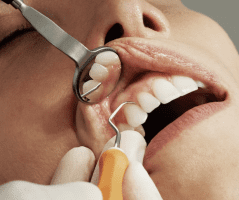 מחלת כליות כרונית מלווה בסיכון מוגבר לאובדן שיניים בנשים לאחר-מנופאוזה (Menopause)