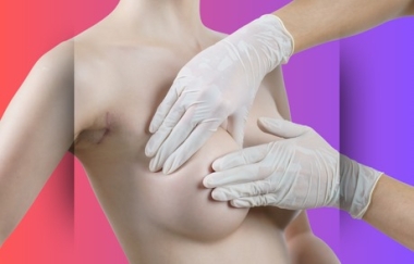 שד סרטן שד BREAST CANCER