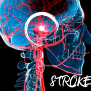 STROKE