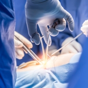 Surgery (10)
