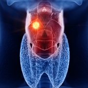 endo33