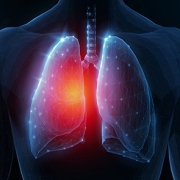 lung35