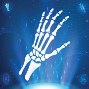 reumo18