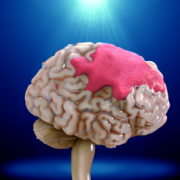 neuro