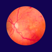 retinopathy