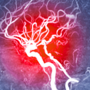 anorisem