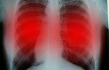 מין, מגדר ו־COPD