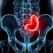 bladder