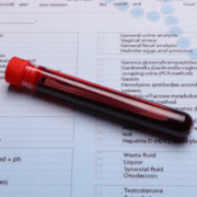anemia