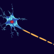 multiple sclerosis