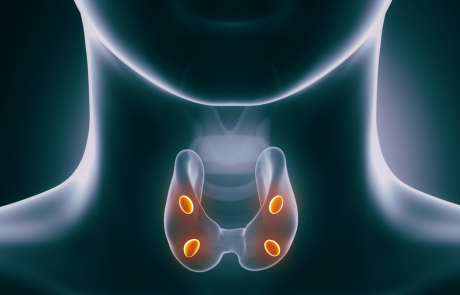 FCH PET/CT לעומת MIBI SPECT/CT לאיכון בלוטות פראתירואיד: ניסוי קליני אקראי