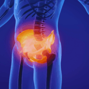 Pelvic fracture1