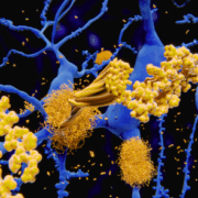 amyloid