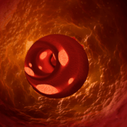 blood clots