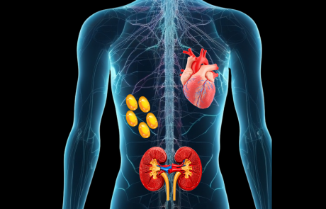 CKM Syndrome המשלב תחלואה לבבית, כליתית ומטבולית מלווה בהגברת אבני כליה