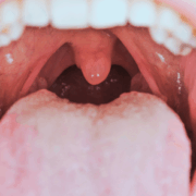 oral cavity