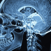 head and neck