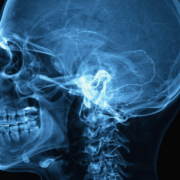 Ear, nose and throat