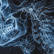 head and neck