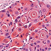 Squamous cells