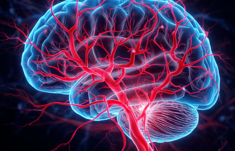 השפעת ניתוח קרניאקטומי להפחתת לחץ (Decompressive Craniectomy) בהתאם למיקום דימום תוך־מוחי עמוק: ניתוח מחקר ה־SWITCH