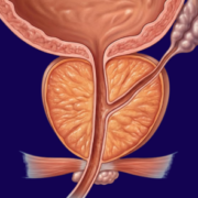 prostate