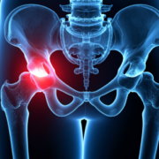 hip